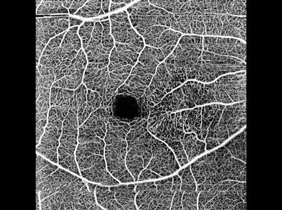 OCTAVIUS 1F — detalle